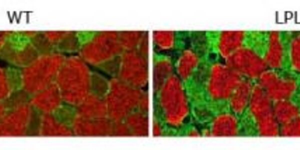 Article teaser image