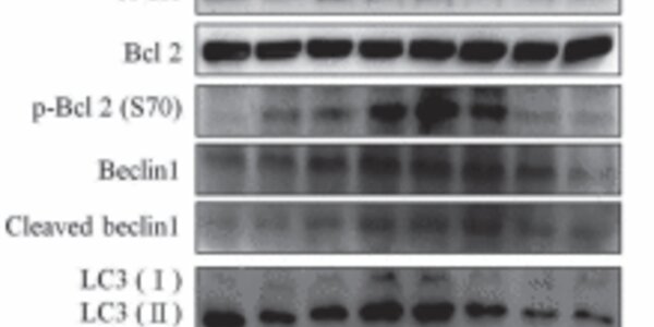 Article teaser image