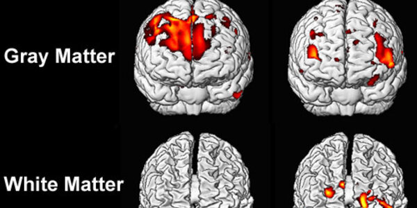 Article teaser image