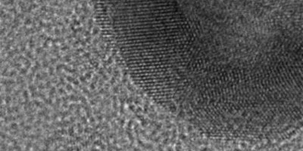 Article teaser image