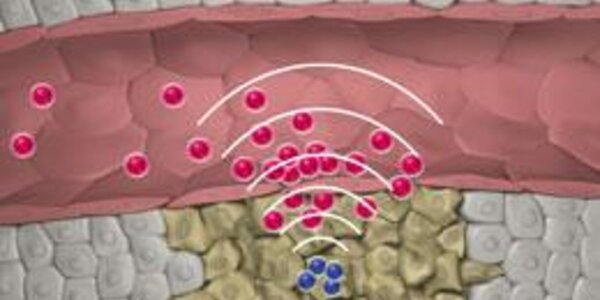 Article teaser image