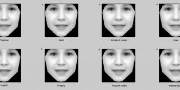 Computer Analysis Of Photographs Could Help Diagnose Rare Genetic Disorders
