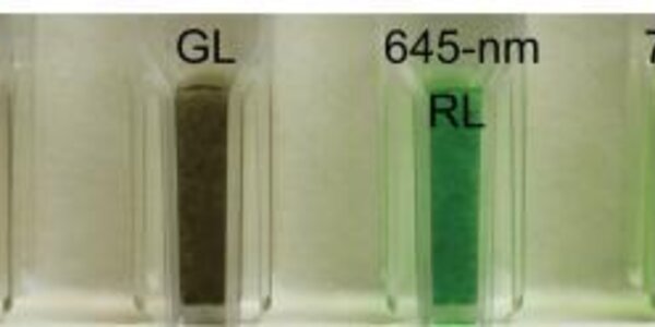 Article teaser image