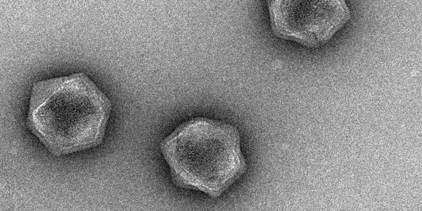 Article teaser image