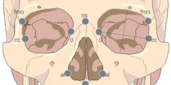 Article teaser image