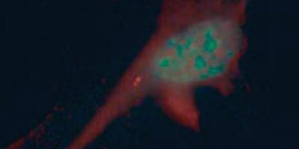 Article teaser image