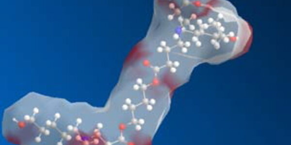 Article teaser image