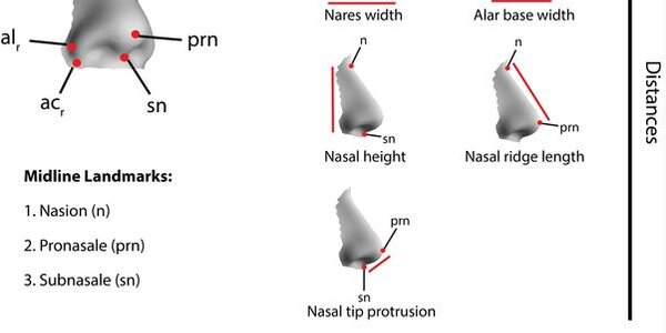 Article teaser image