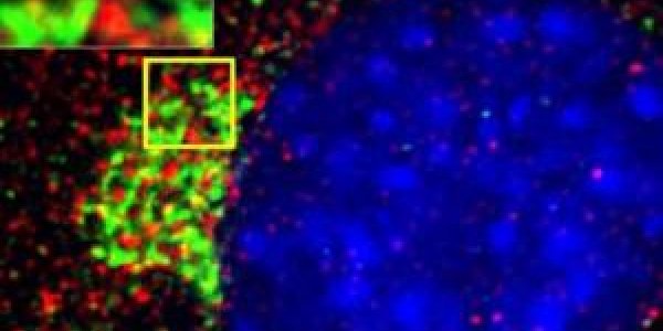 DR Cysteamine May Prove New Hope for Treating Huntington's Disease