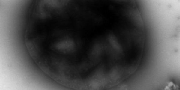 Using Microbes To Convert Natural Gas Into Electricity