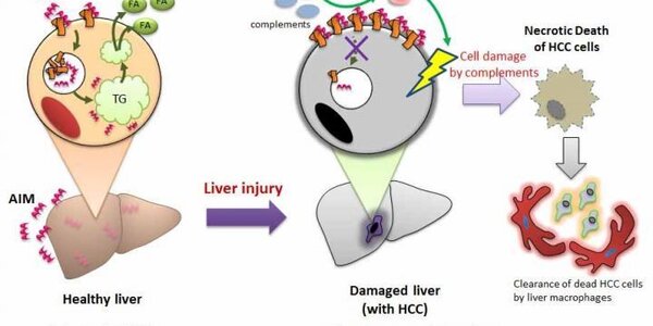 Article teaser image