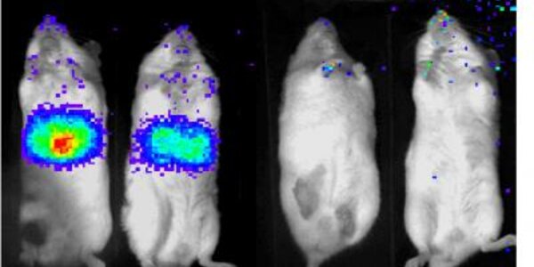 Article teaser image