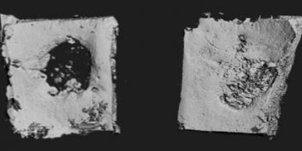 Bio Patch That Can Regenerate Bone