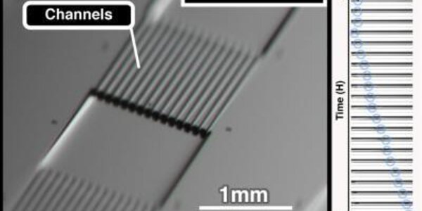 Article teaser image