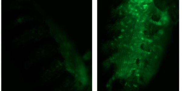 A '"Transposon Theory Of Aging"