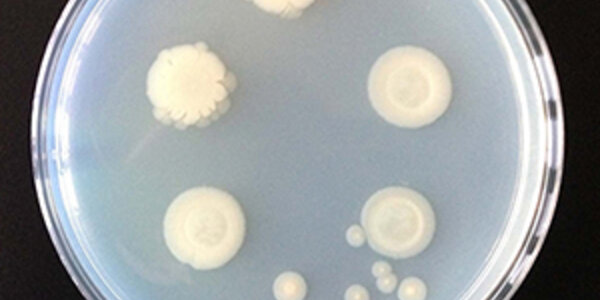 Article teaser image