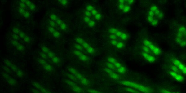 Article teaser image