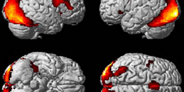 Article teaser image