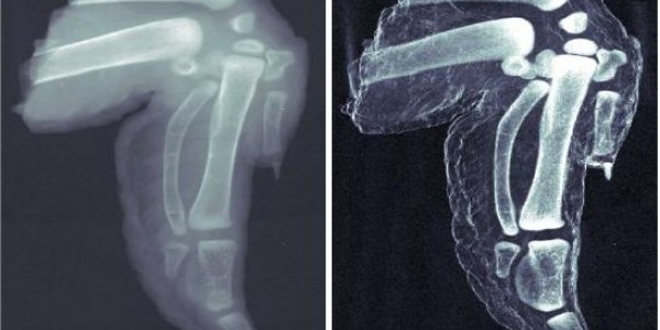 Better X-Rays: Dark-Field Imaging Using Standard Equipment