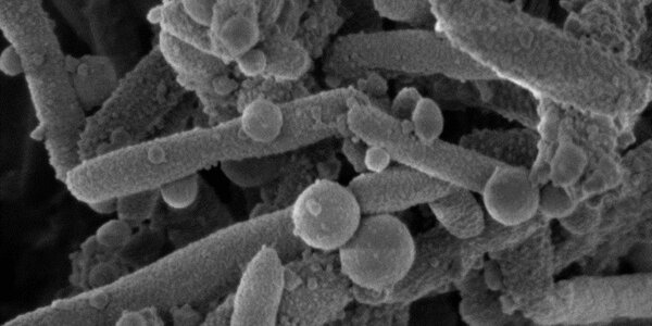 Article teaser image