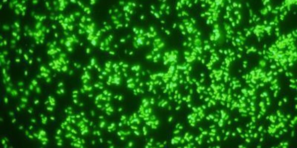 Article teaser image