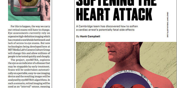 Article teaser image