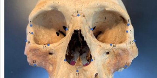 Article teaser image