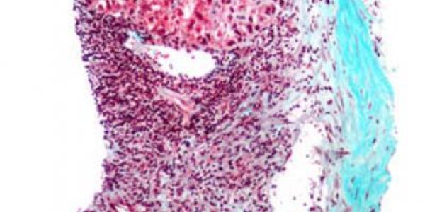 Article teaser image