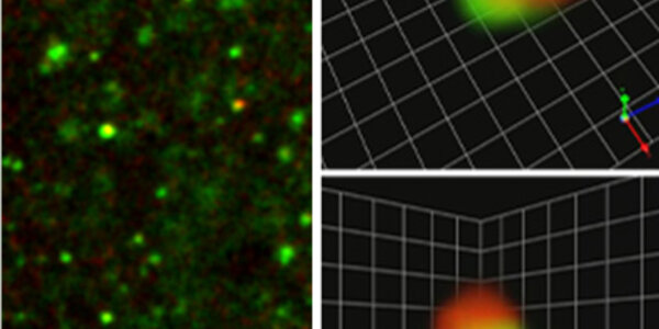 Article teaser image