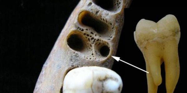 Article teaser image