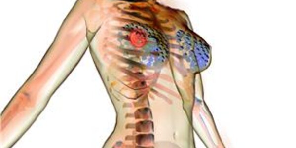 Article teaser image