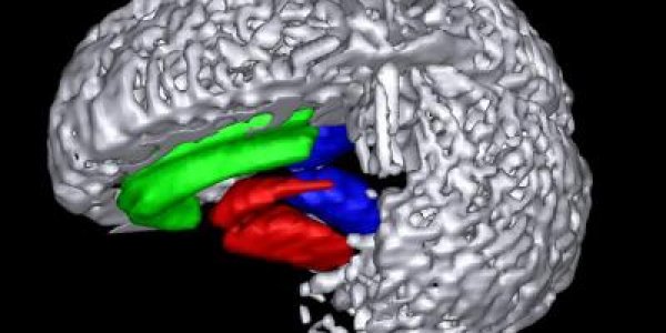 Brain scans reveal cause of smokers' cravings