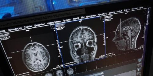 Left Brain, Right Brain: Both Hemispheres Process Numbers
