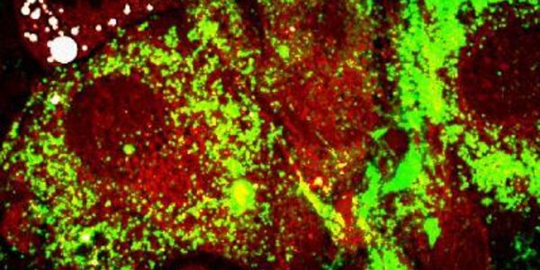 Article teaser image