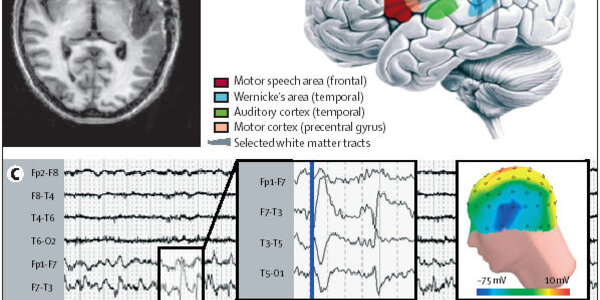 Article teaser image