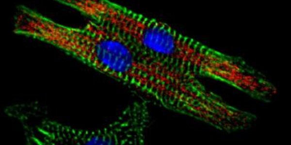 Article teaser image