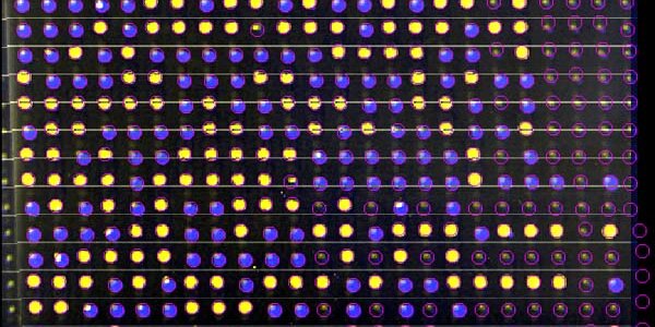 Article teaser image