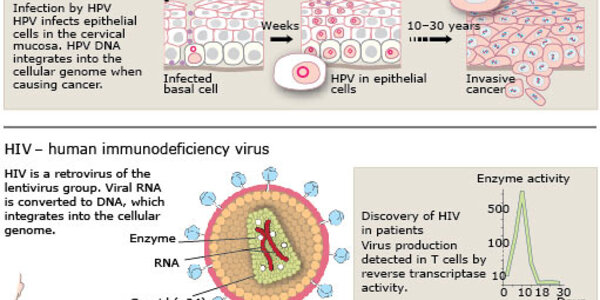 Article teaser image