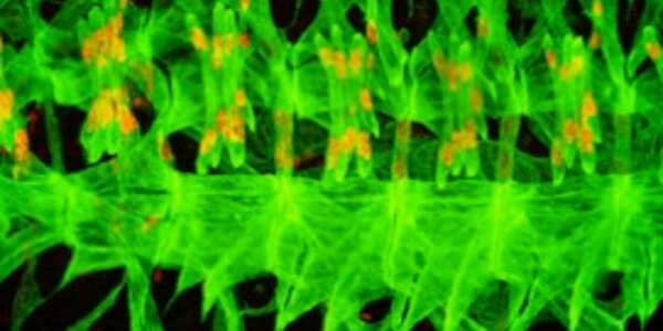 Article teaser image