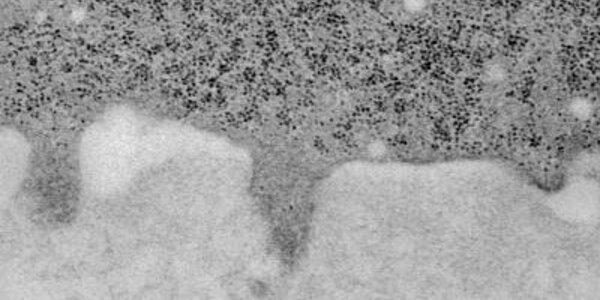 Article teaser image