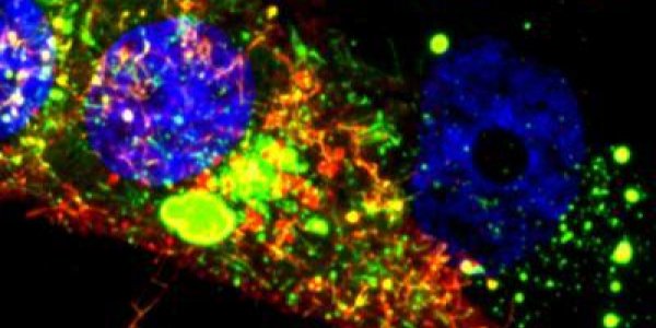 Imaging Technology Could Unlock Mysteries Of Childhood Respiratory Syncytial Virus