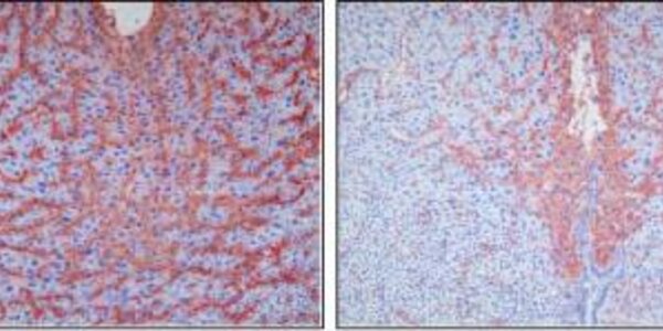 Article teaser image