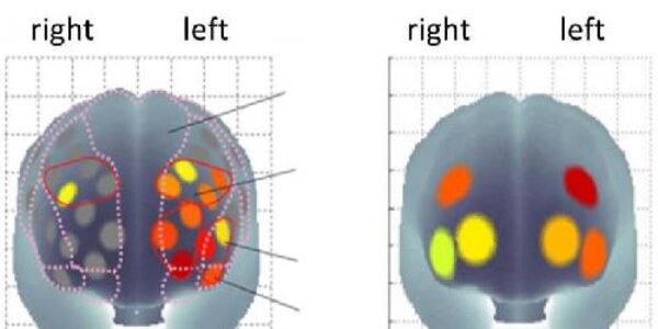 Article teaser image