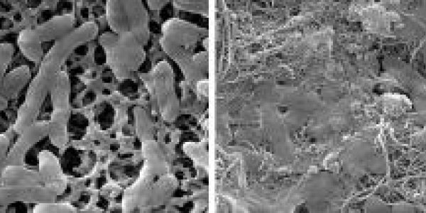 Using Nanotechnology To Fight E. Coli