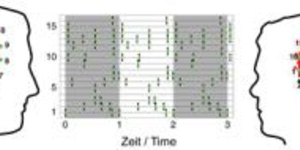 Article teaser image