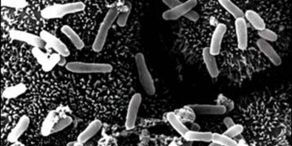 Article teaser image