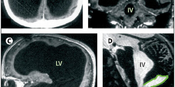 Article teaser image