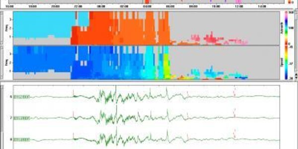 Article teaser image