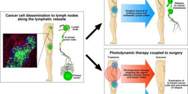 Article teaser image