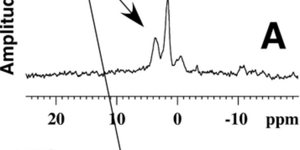 Article teaser image